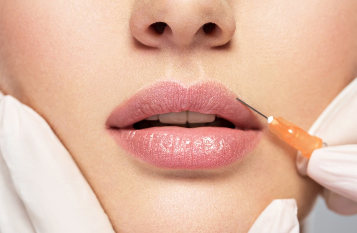 Acide hyaluronique lèvres à Dijon | Esthétique | Injection acide hyaluronique bouche | Centre Médical Laser
