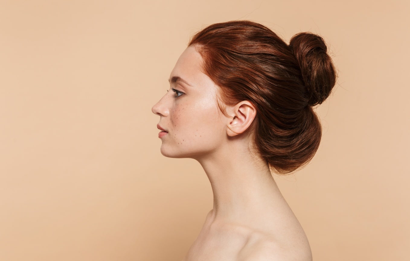 Rhinoplastie médicale à Dijon | Esthétique | Rhinoplastie médicale prix | Centre Médical Laser